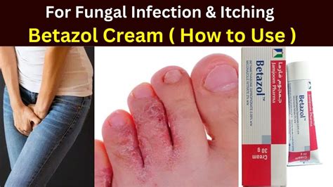 Betazol Cream Uses Best Antifungal Cream For Private Area Betazol Cream For Fungus Youtube