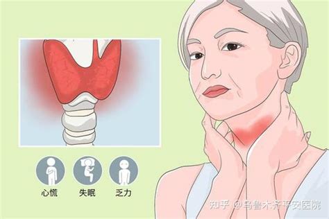 促甲状腺激素是什么为何对甲状腺如此重要 知乎