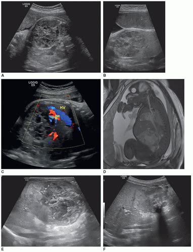 The Pediatric Abdomen Radiology Key