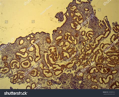 Photomicrograph Crosssection Human Endometrial Tissue Showing Stock