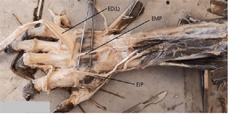 Extensor Medii Proprius Emp Eip Tendon Of Extensor Indicis