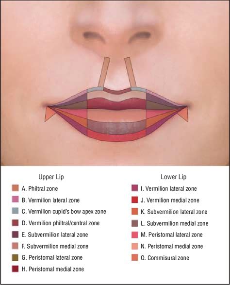 Figure 1 From A New Classification Of Lip Zones To Customize Injectable