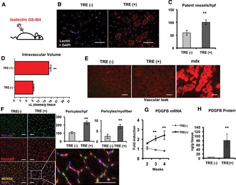 Pgc 1α Induces Spp1 To Activate Macrophages And Orchestrate Functional