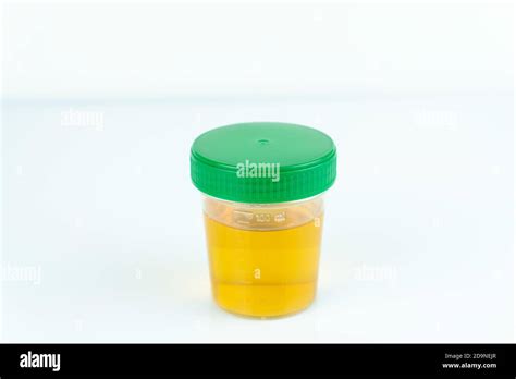 Check Up Routine Urinalysis Reagent Strip For Urinalysis Stock Photo