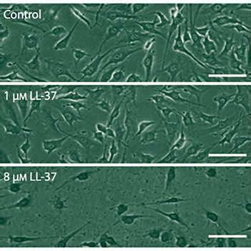 Staining With Trypan Blue Assessing Cell Viability Shows That