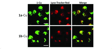 Fluorescence Microscope Images Of Hela Cells Incubated With A Cu And