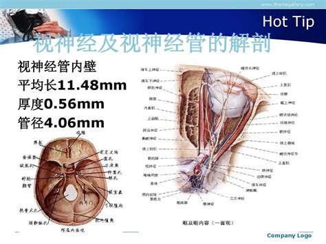 视神经管减压术word文档在线阅读与下载无忧文档