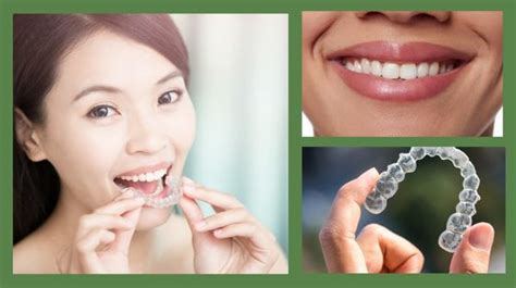 How To Improve Your Dental Health With Invisalign