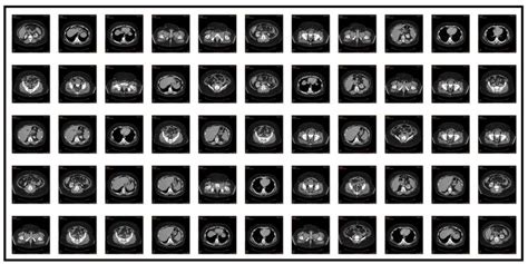 2 Example Of Ct Slices With Slice Thickness Of 1 Mm Download Scientific Diagram