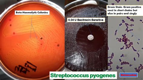 Streptococcus Pyogenes Shape