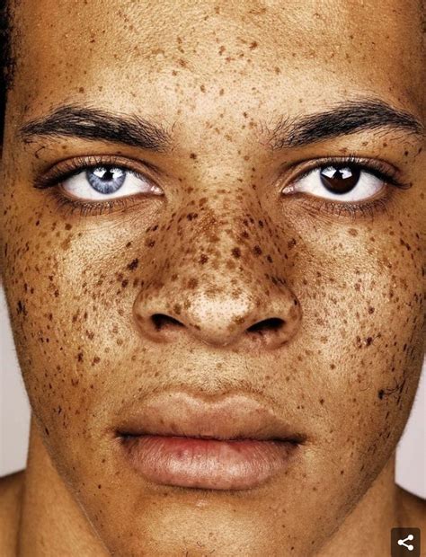Freckled people | Freckles, Portrait, Freckle face