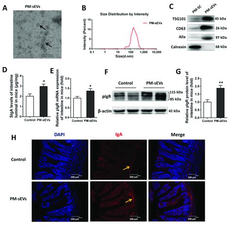 Identification Of Pm Sevs And Effect Of Pm Sevs On Intestinal Siga