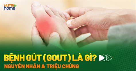 Bệnh Gút Gout Là Gì Dấu Hiệu Nguyên Nhân Và điều Trị