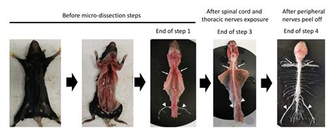 Whole Central And Peripheral Nervous System Mice Dissection Scientific