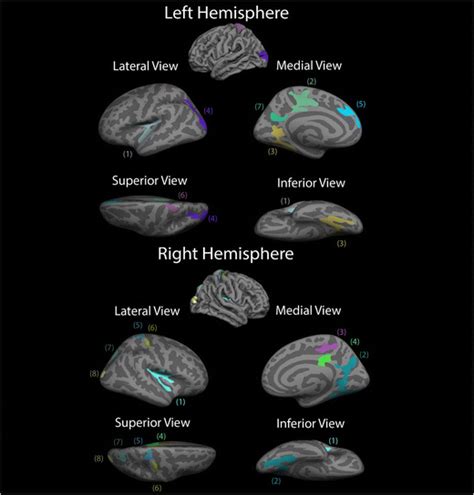 Clusters Of Significant Cortical Thinning Each Of The Colors