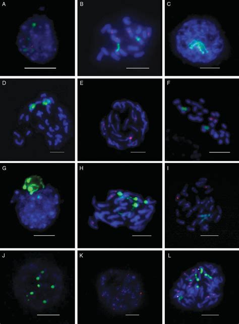 Fluorescent In Situ Hybridization With S Green And S Red Rdna