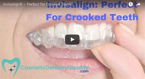 Invisalign Perfect For Crooked Teeth Cosmetic Dentistry Near Me