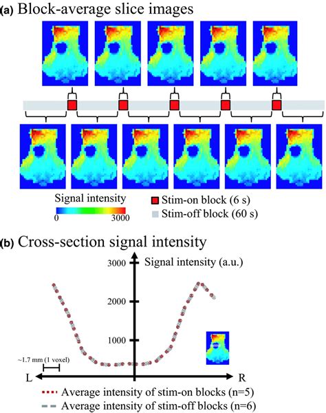 Assessment Of An Electric Currentinduced EPI Image Artifact A Single