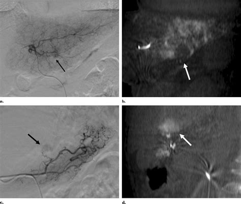 Usefulness Of Cone Beam Volume Ct With Flat Panel Detectors In