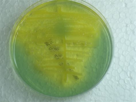 E Coli Urine Culture