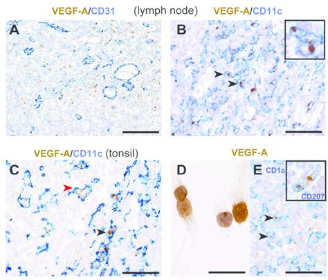 Distribution And Phenotype Of Vegf A Producing Cells In Human Reactive