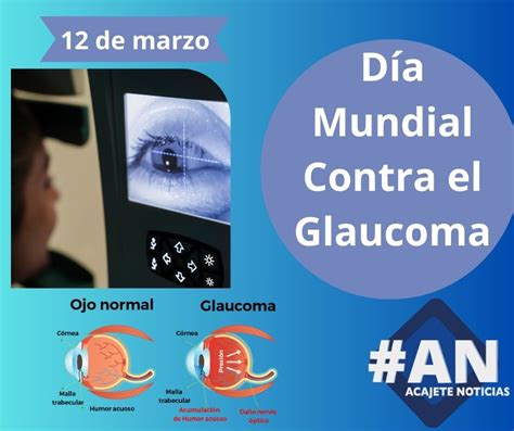 Día Mundial Contra El Glaucoma Acajete Noticias