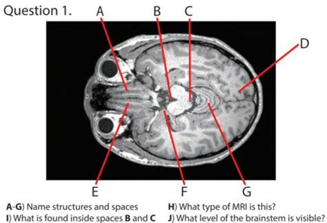 Week Mri Flashcards Quizlet