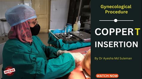 کاپر ٹی Copper T Insertion Explained Guide For Medical Practitioners