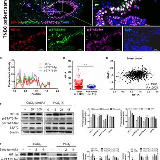 HIF1α STAT3 activation and colocalization in breast cancer cells A