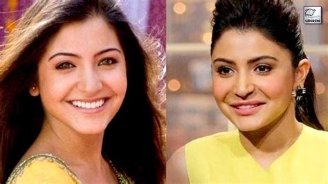 Priyanka Chopra To Anushka Sharma Actresses Who Had Plastic Surgery