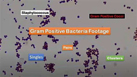 Gram Positive Cocci In Singles Pairs And Clusters Staphylococcus