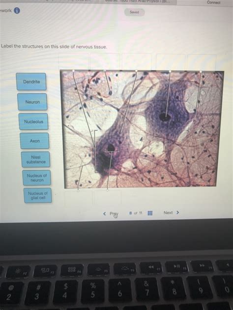 Solved Work Saved Label The Structures On This Slide Of Chegg