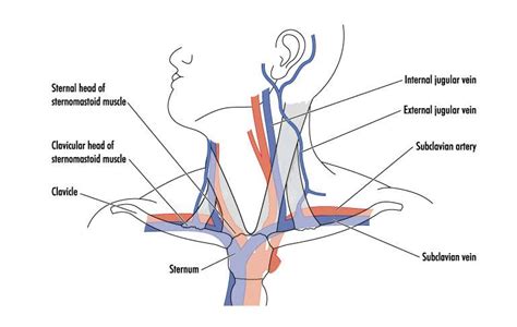 Swollen Submental Triangle