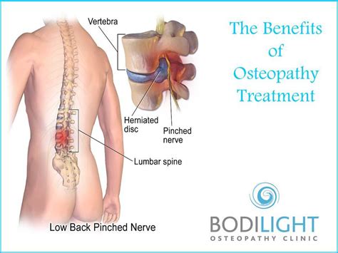 The Benefits Of Osteopathy Treatment Bodilight Osteopathy