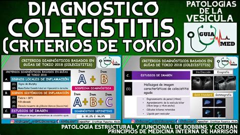 CRITERIOS DE TOKIO COLECISTITIS GuiaMed YouTube