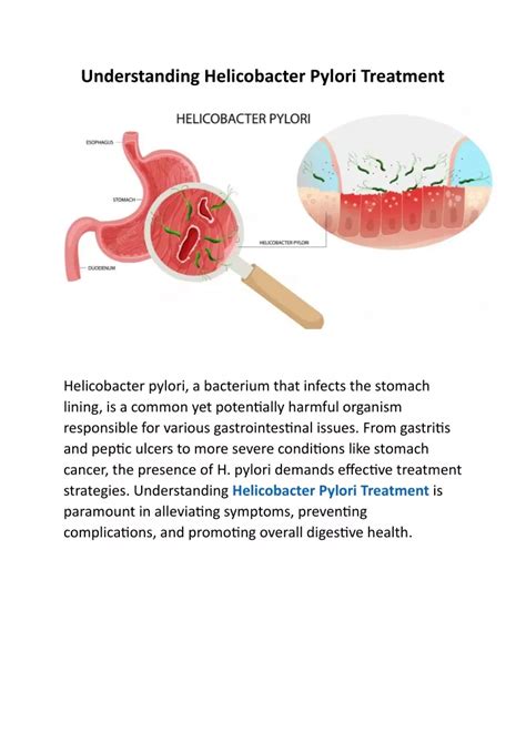 PPT - Understanding Helicobacter Pylori Treatment PowerPoint Presentation - ID:12941745