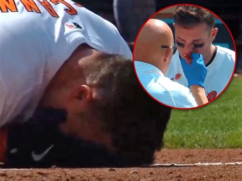 Orioles James Mccann Drilled In Face By Mph Fastball