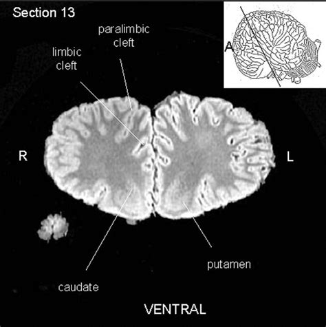 Orca Brain Size