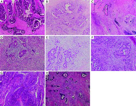 Examples Of A DR TBd And TSR On Hematoxylin And Eosin Stained Slides