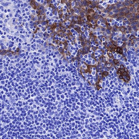 S Rmab® P120 Catenin Recombinant Rabbit Mab Sdt 350 75o60716starter Bio