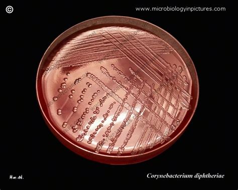 Corynebacterium Diphtheriae On Sheep Blood Agar Plate Bap Appearance