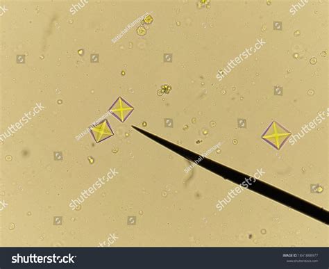 836 Calcium oxalate. Images, Stock Photos & Vectors | Shutterstock