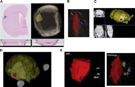 D Reconstruction Of Mri And Histological Sections A Serial Perls