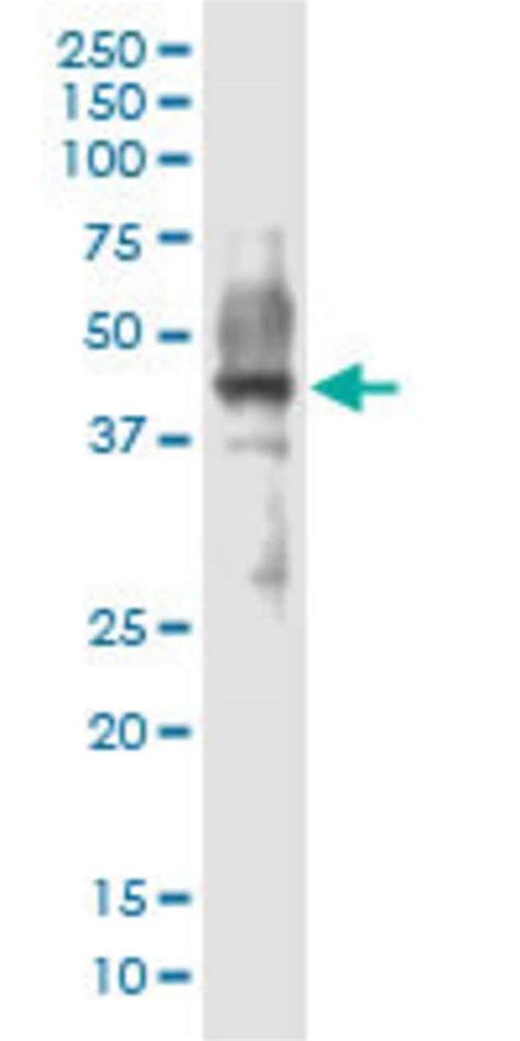 Arrb Mouse Anti Human Rat Unconjugated Clone D Abnova G