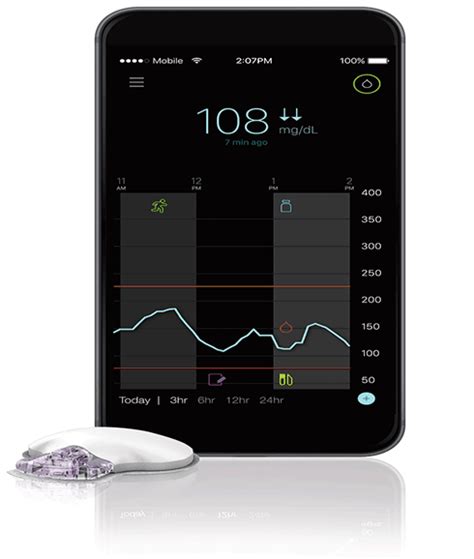 Medtronics New Guardian Connect Smartphone Powered Glucometer