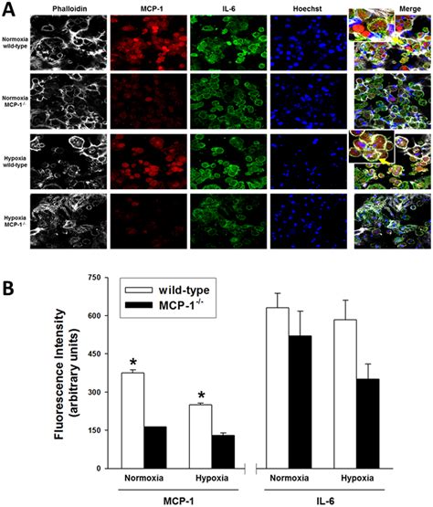 Differential Expression Of Mcp And Il In Wild Type And Mcp