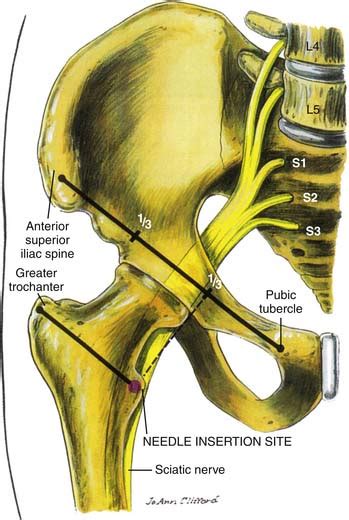 Sciatic Nerve Block Landmarks