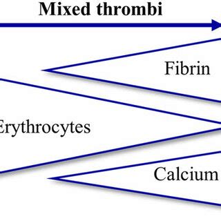 thrombus types   compositions  red  white thrombi
