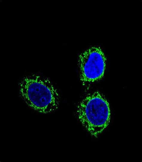 IHC-plus™ NPHS1 / Nephrin Monoclonal Antibody Mouse anti-Human | LSBio