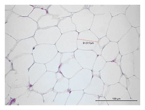 Histology Of The Epididymal White Adipose Tissue WAT Of Mice In The